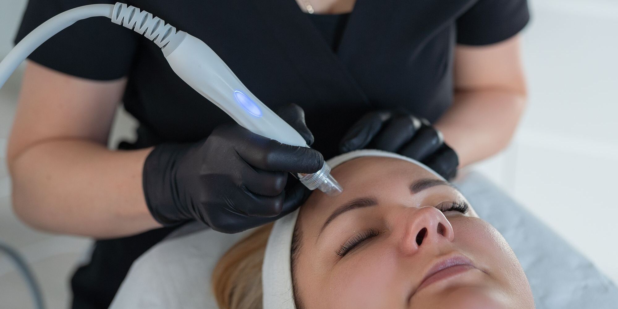 Oczyszczanie wodorowe